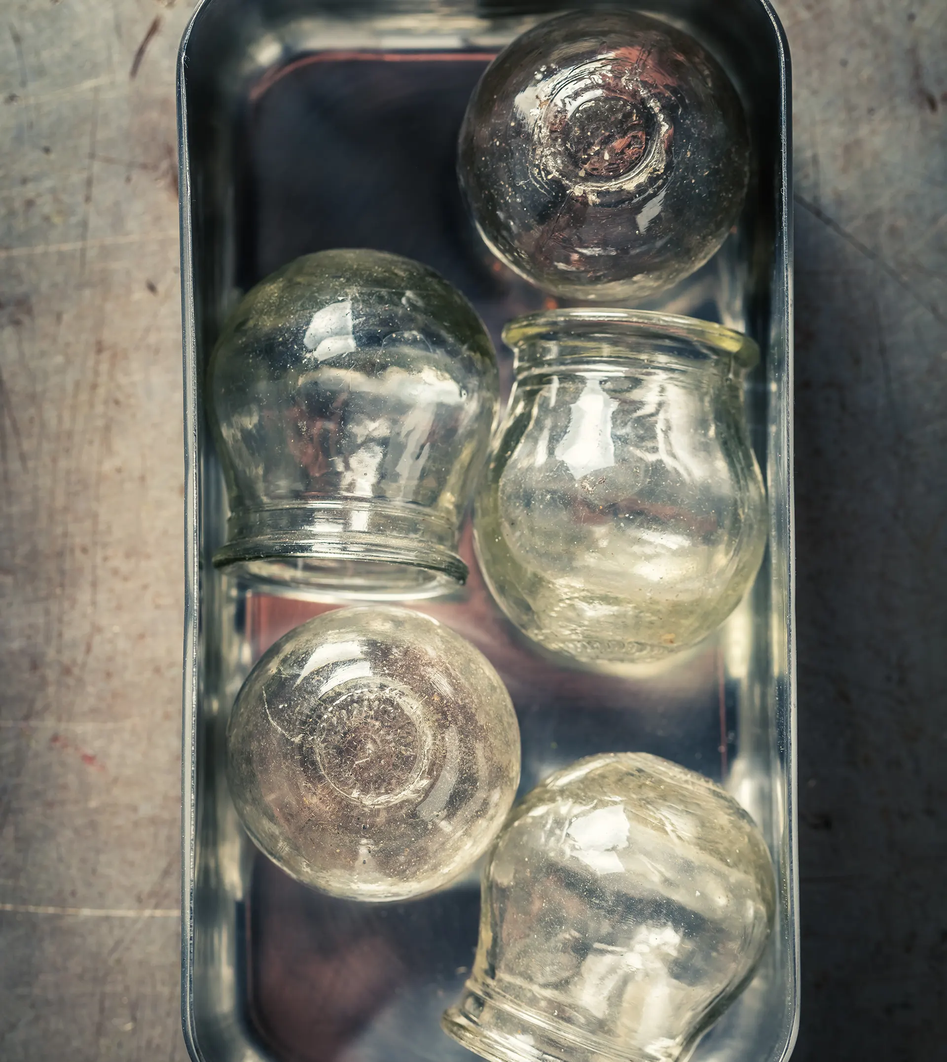 Professional Cupping Therapy